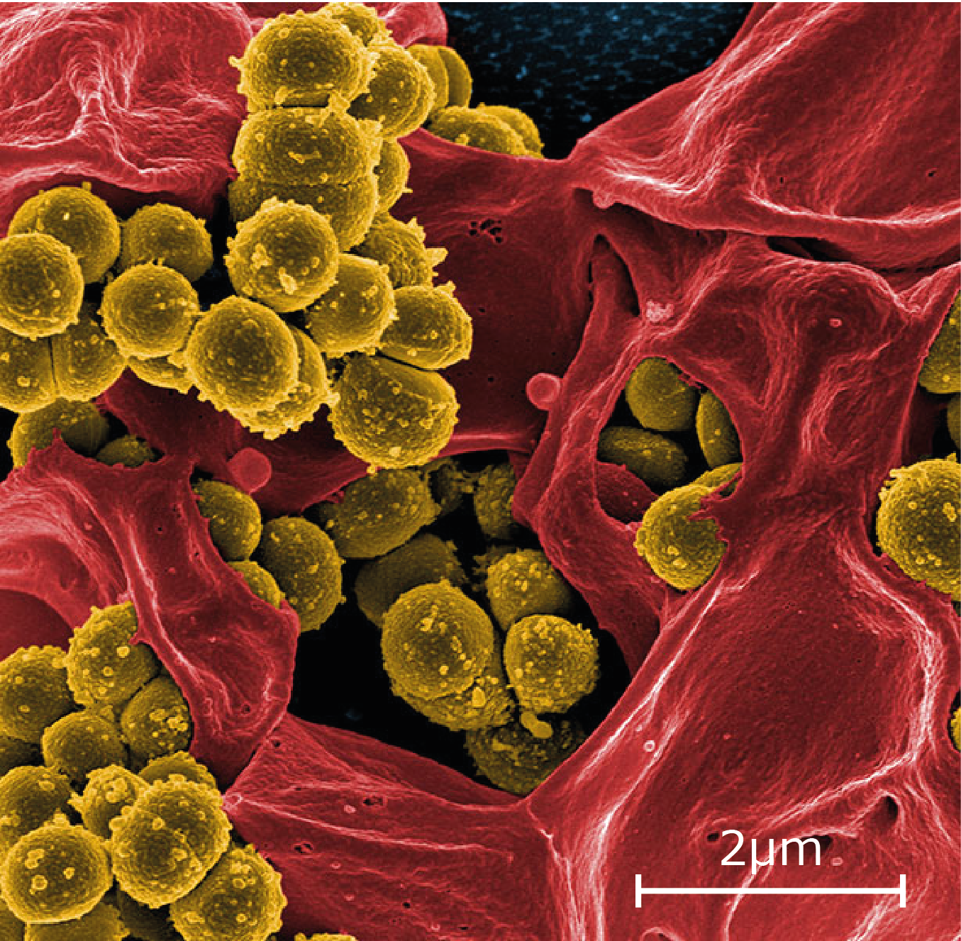 Staphilococcus Aureus Sq Scale
