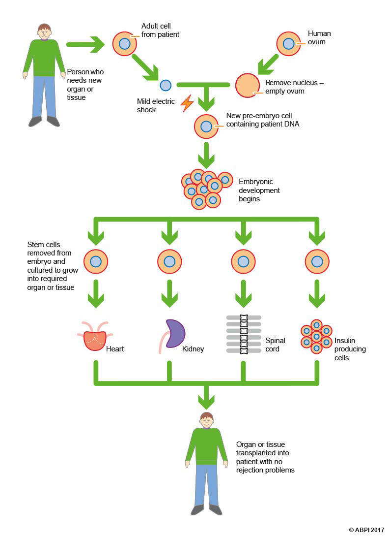 The nucleus of a cell from a patient who needs a new organ or tissue is extracted. A mild electric shock is applied so the nucleus fuses with an empty ovum. The new pre-embryo cell contains the patient’s DNA. After embryonic development, stem cells are removed and cultured to grow into the required organ or tissue, such as a heart, a kidney, a spinal cord or insulin-producing cells. The cloned organ or tissue is then transplanted into the patient with no rejection problems.