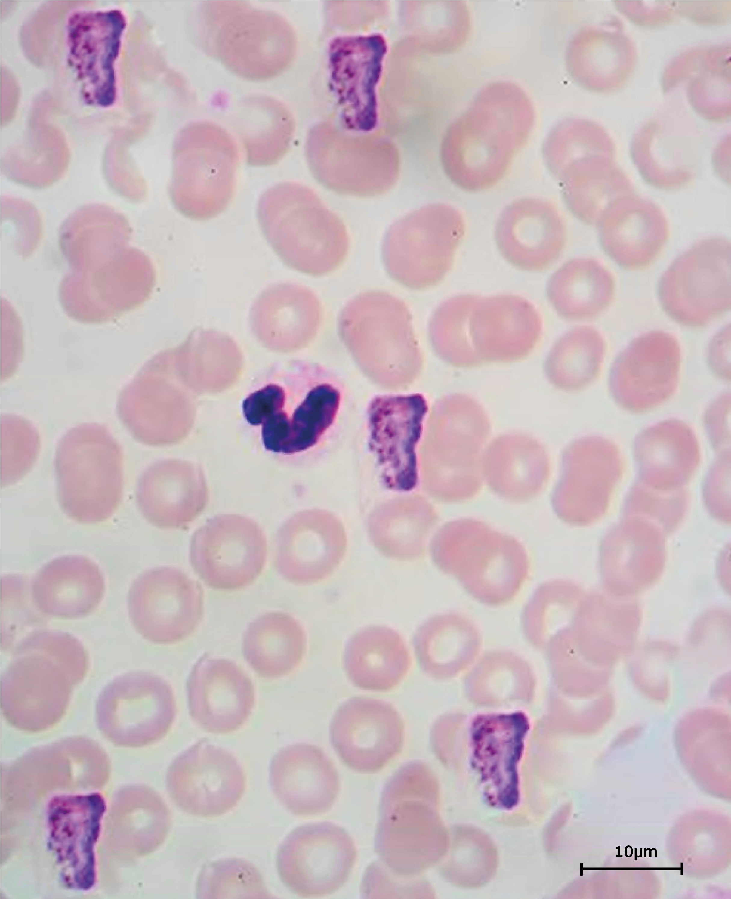 Malaria Blood Smear Scaled