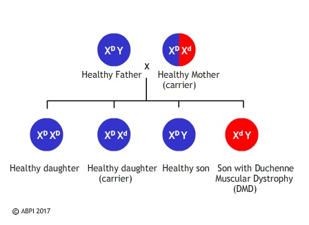 Duchenne