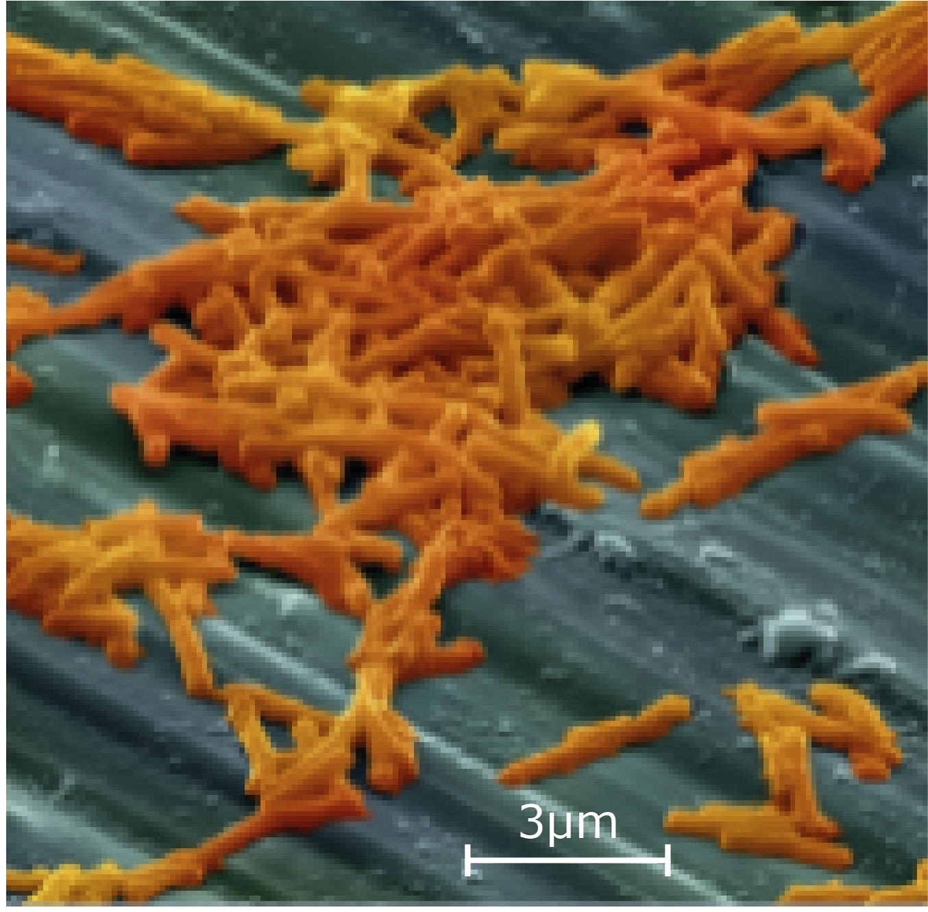 Clostridium Sq Scale