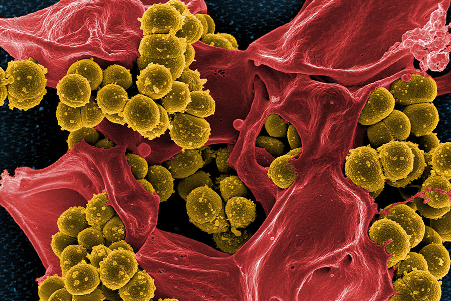 Methicillin Resistant Staphylococcus Aureus