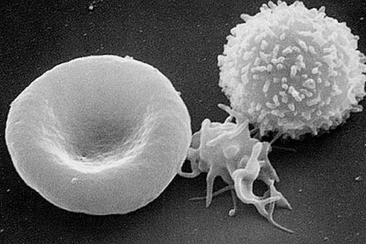 Scanning Electron Micrograph Cells