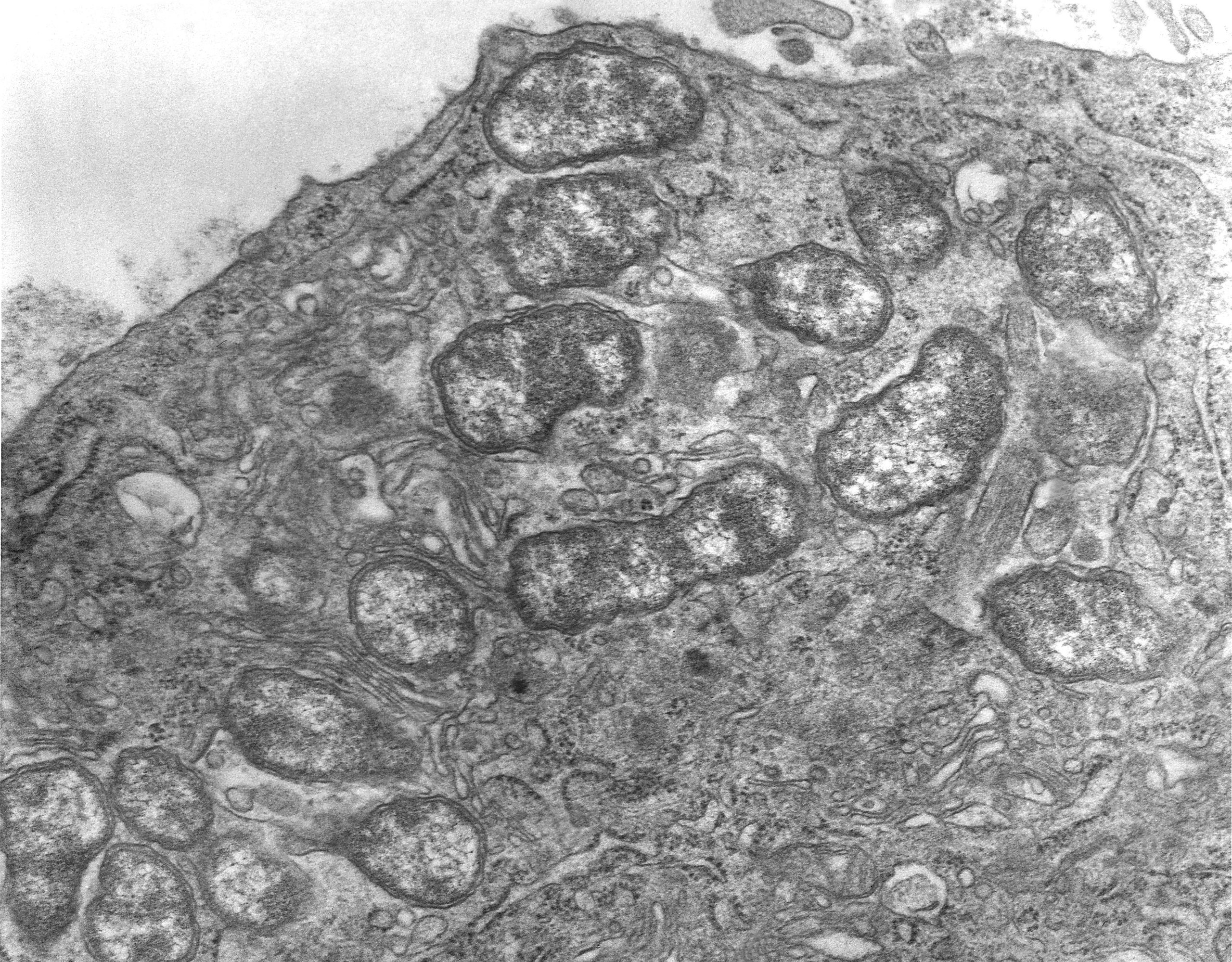 Mesothelial Cell