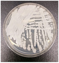 Petri dish growing Candida auris