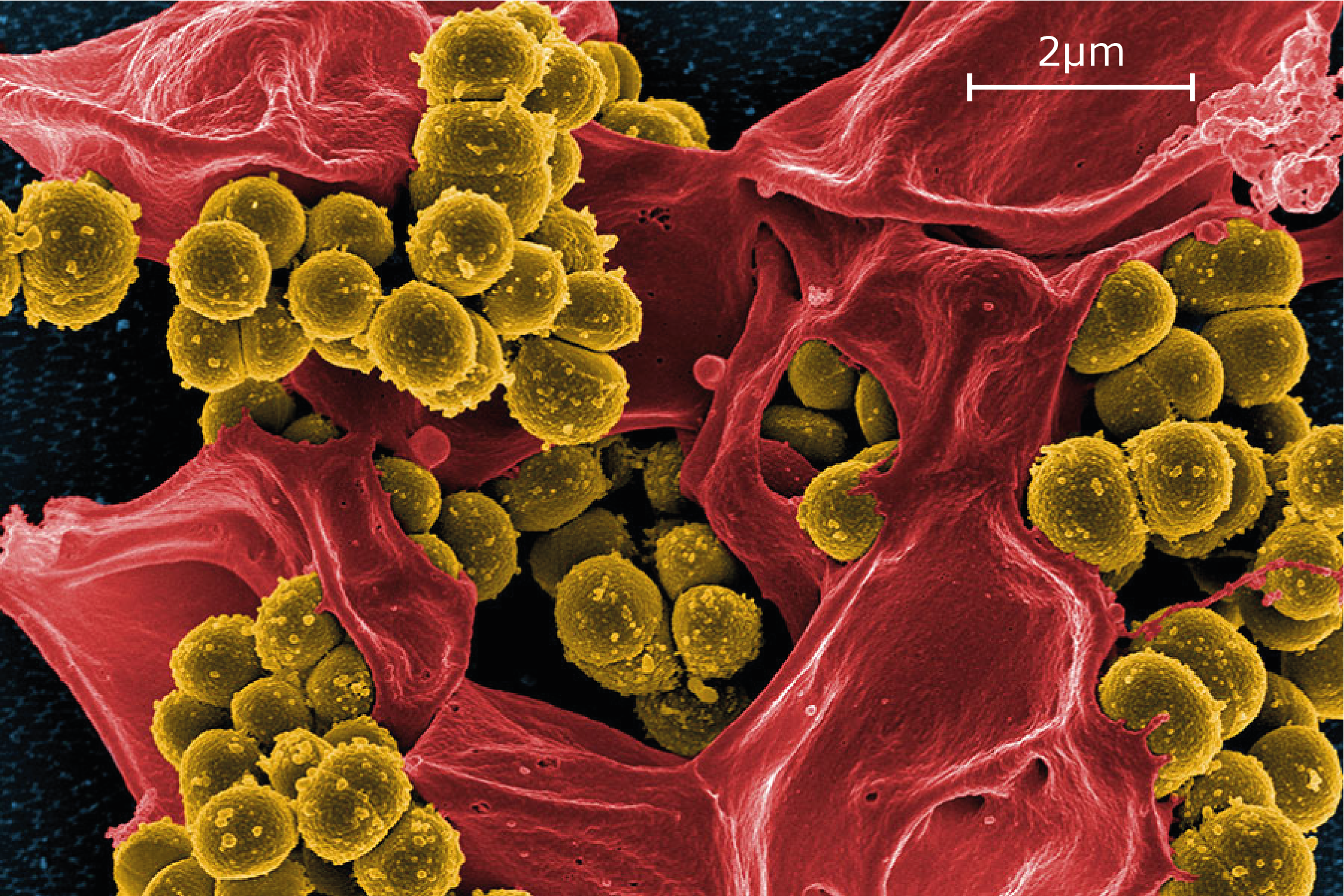 Staphilococcus Aureus Scale