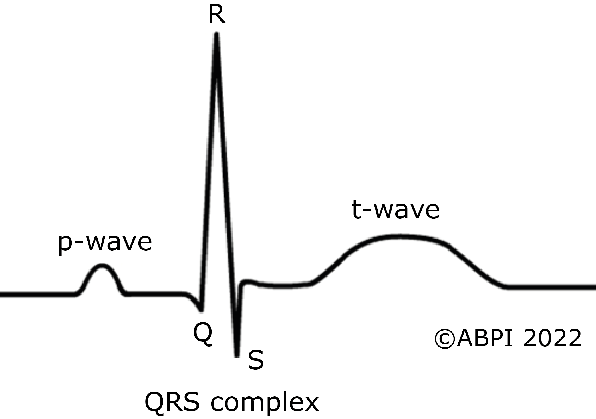 Ecg Plot