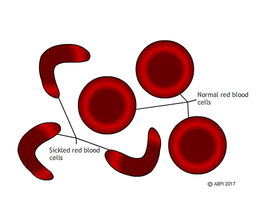 case study on gene therapy