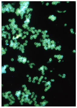 Fluorescent stained Neisseria gonorrhoeae shown under fluorescent microscopy