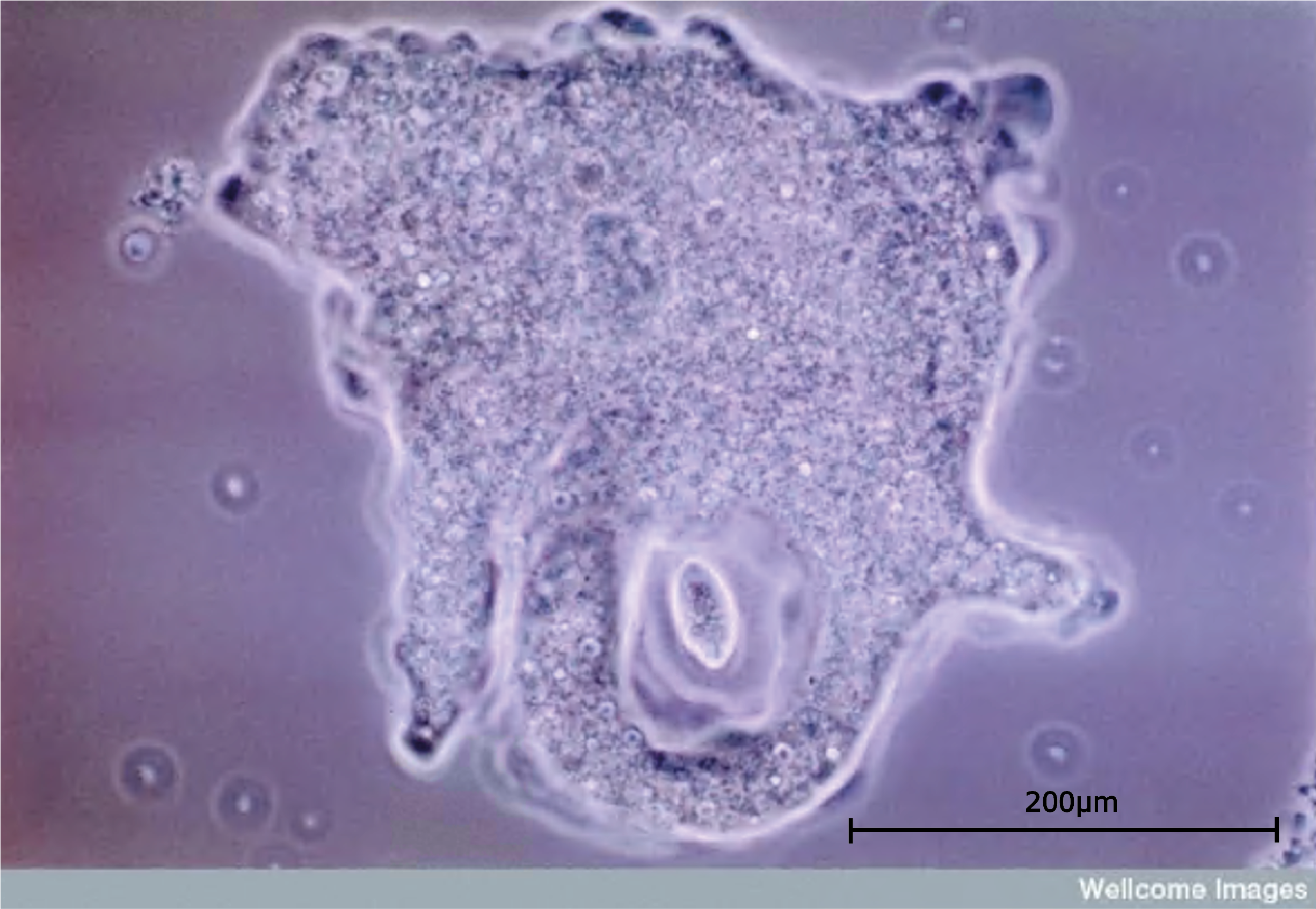 protista amoeba