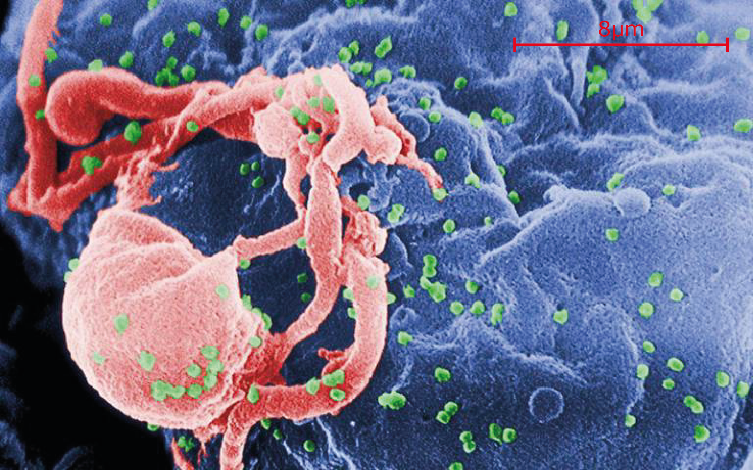 Hiv Vs Lymphocyte Scale