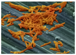 Clostridium difficile shown under scanning electron microscopy