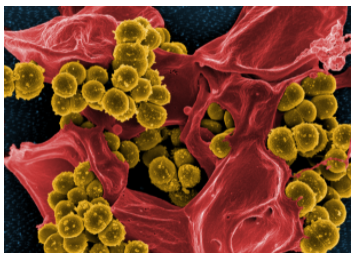 Staphylococcus aureus shown under scanning electron micrograph