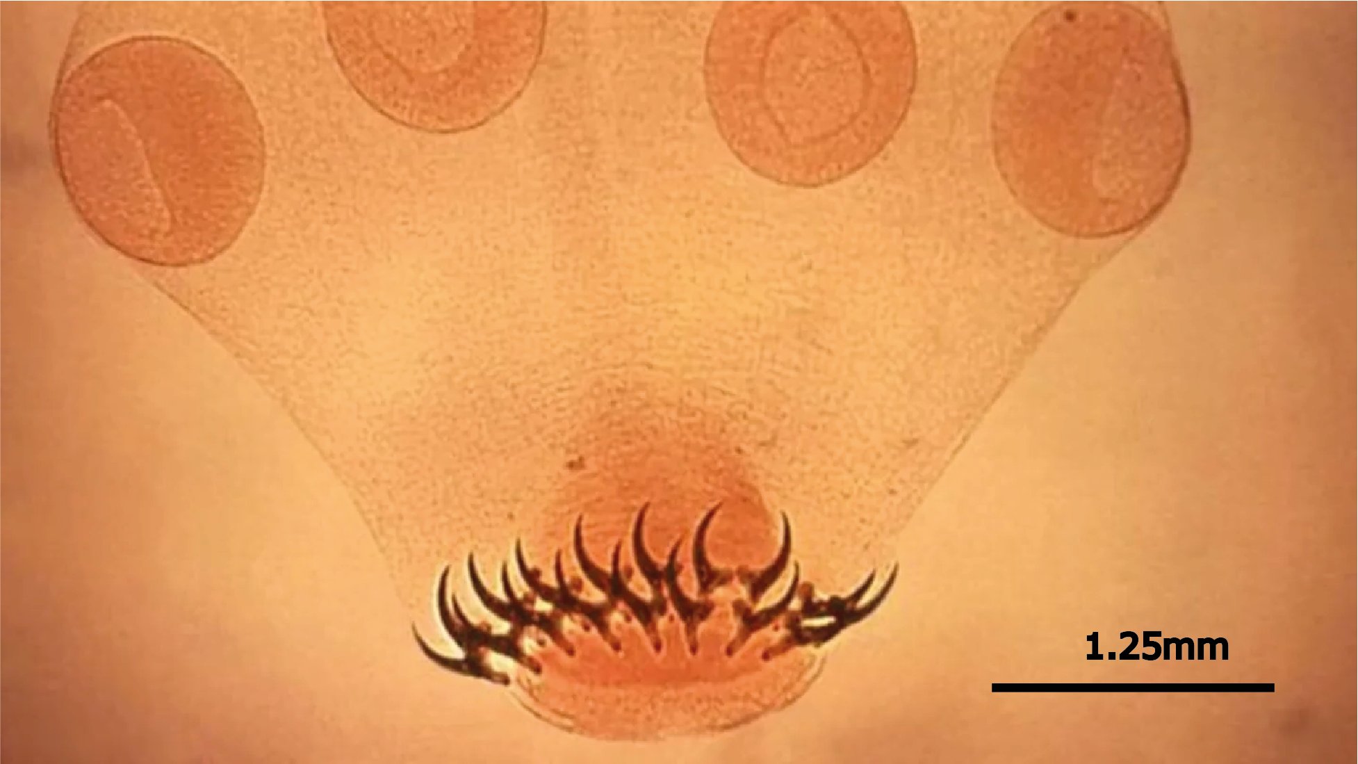 Tape Worm Width Scale (1)